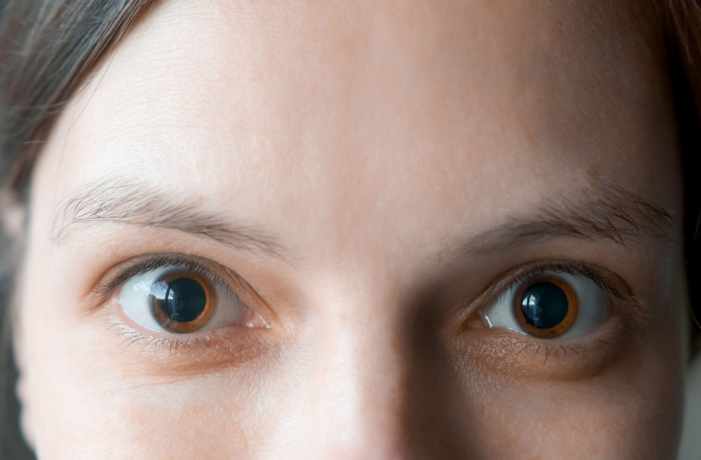 A close-up of a woman's dilated pupils.